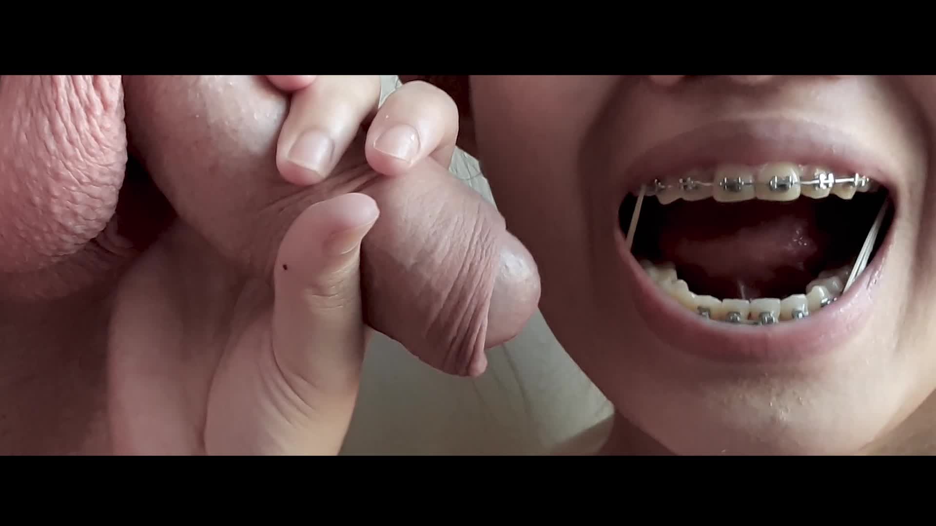 Asian with braces elastics sucks white cock and foreskin