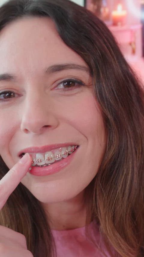 Braces smile looking extra cute today