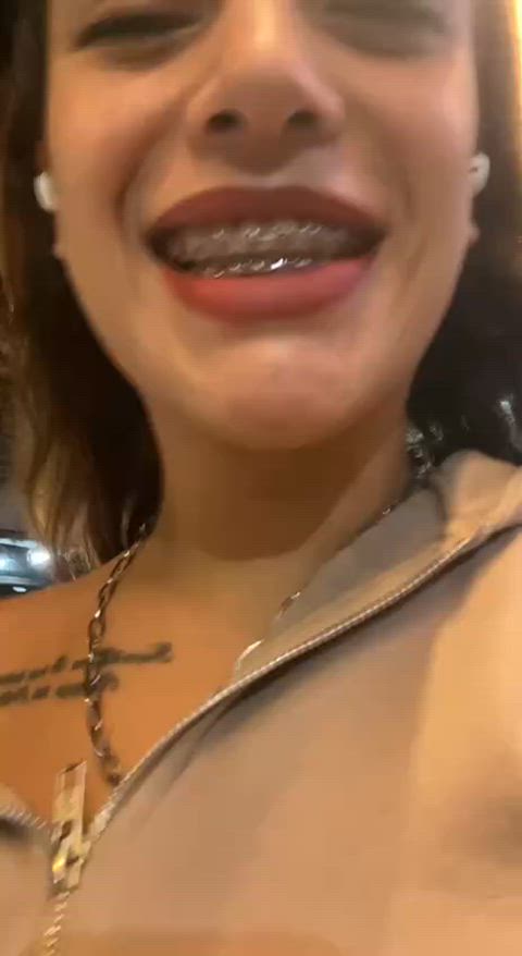 I'm getting my adjustment now, I'll be ditching my pink rubber bands for a month...