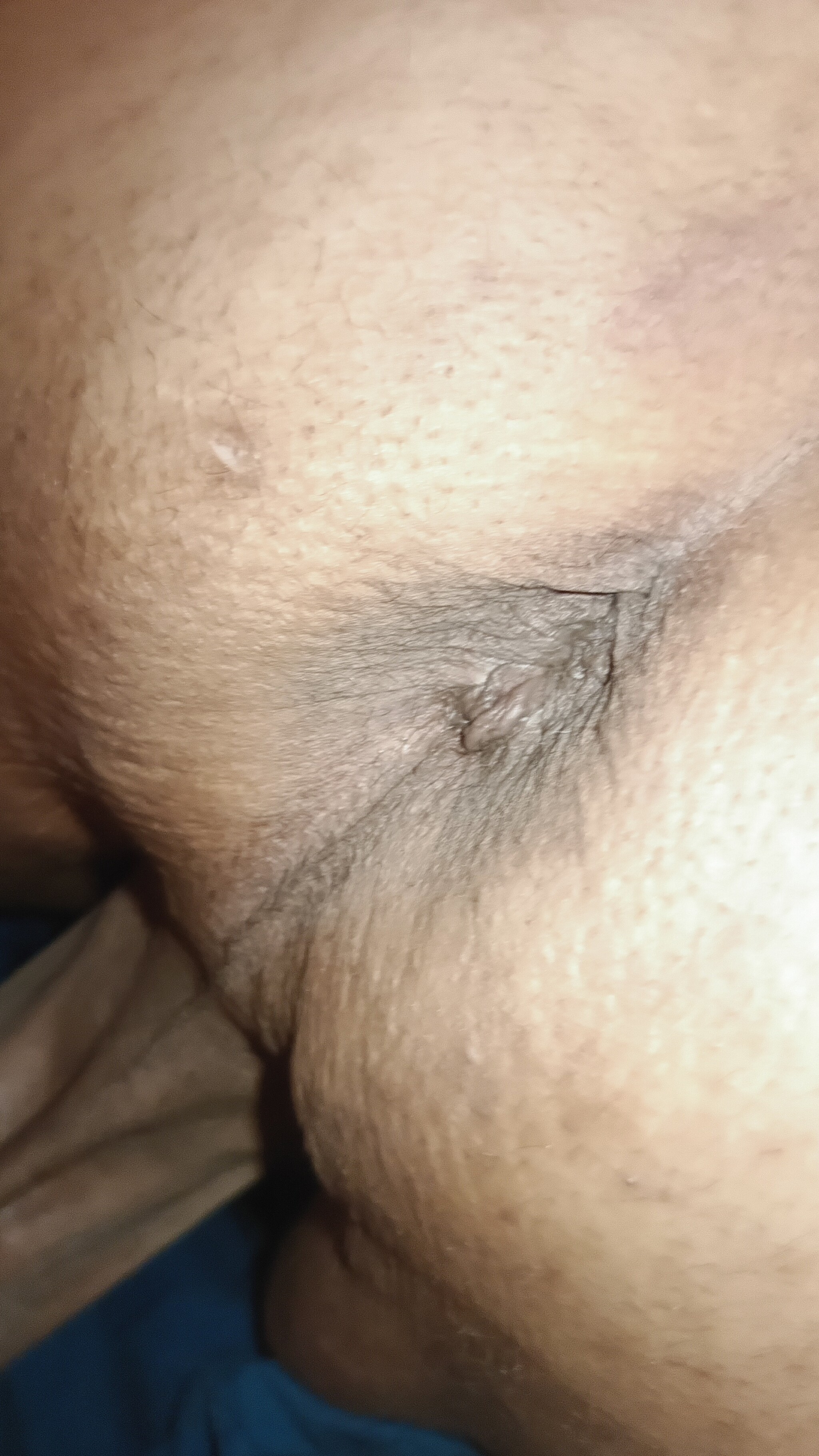 General anal ass booty
