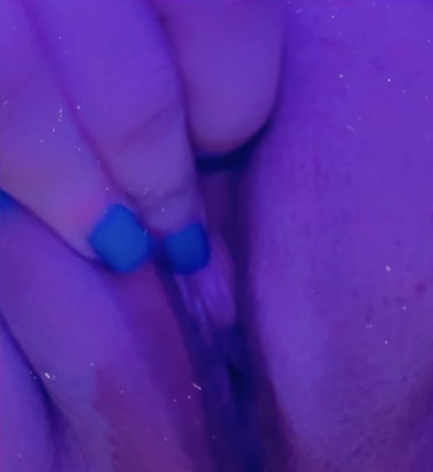Teasing