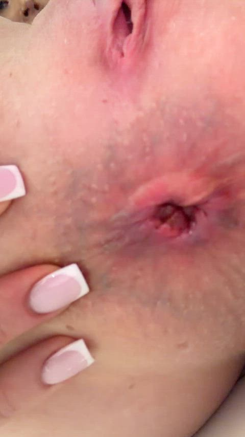 DryBronzeAnkolewatusi thumbnail