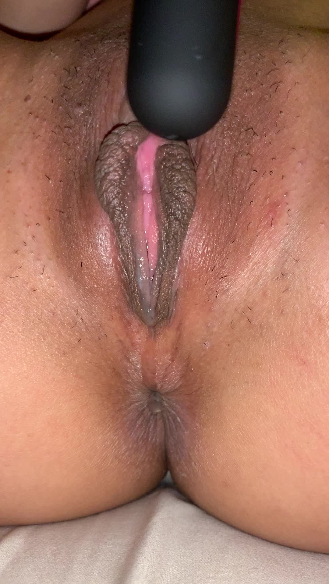 My lips need attention