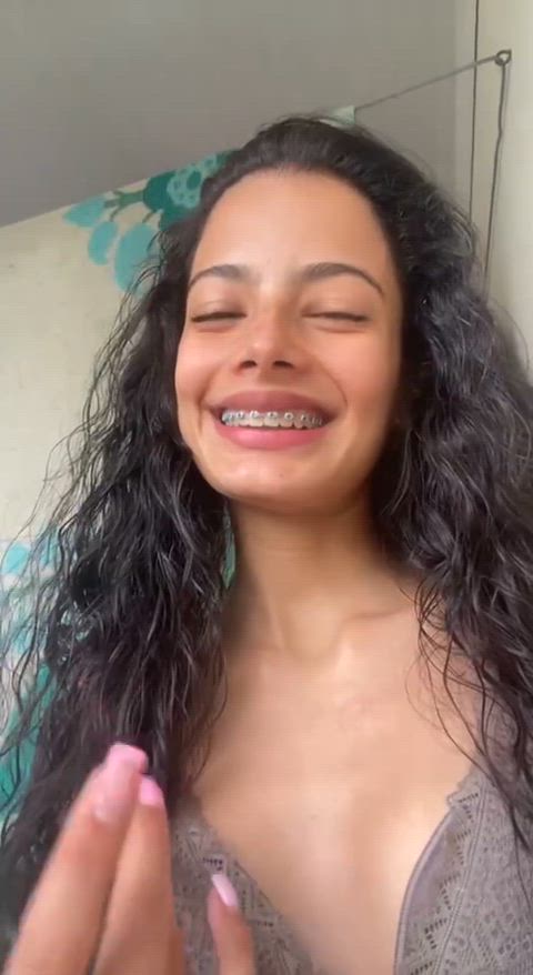 [CONTENT] Do older guys think I’m attractive… even with braces