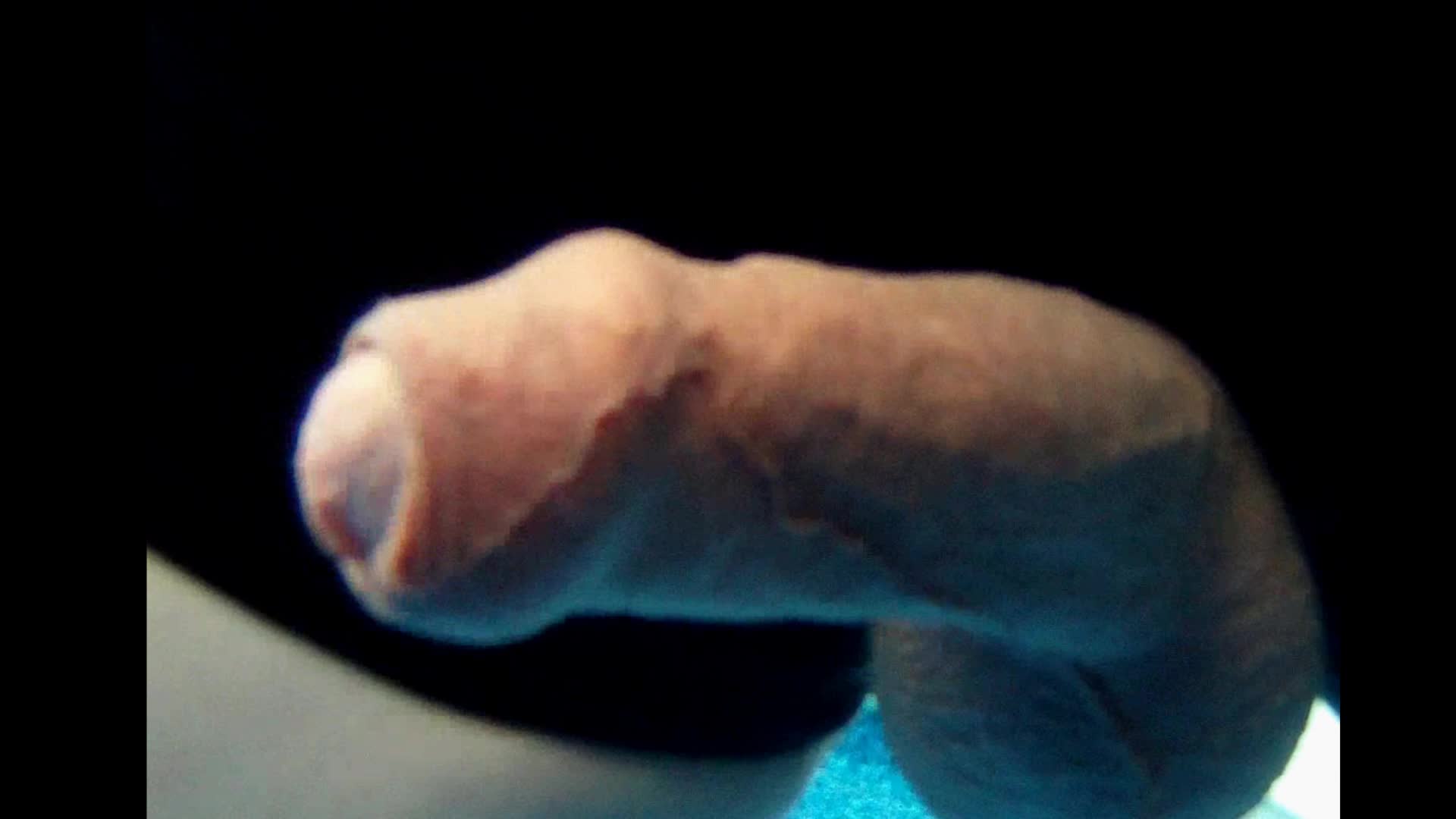 Intact Penis Reacts To Water Jet
