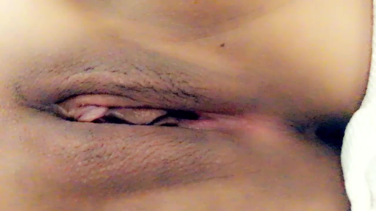Counting birthmarks