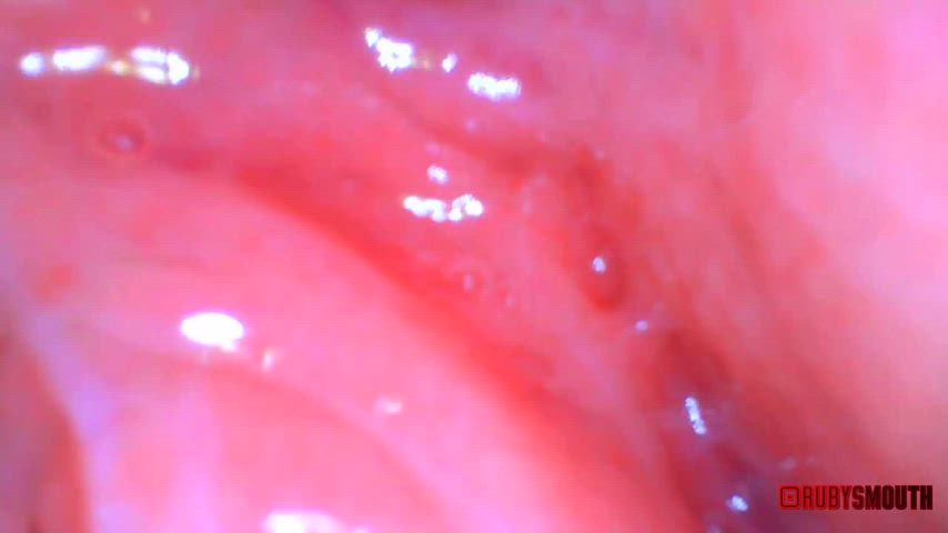 the secret behind Ruby's uvula