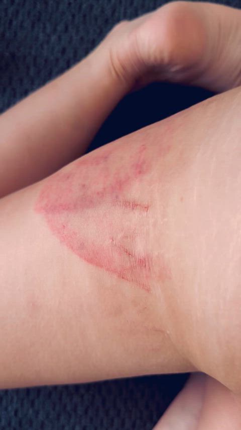 Scarring Daddy’s name into my bruised thigh always reminds me that I am His