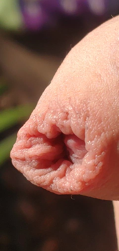 (40) used to hate my foreskin