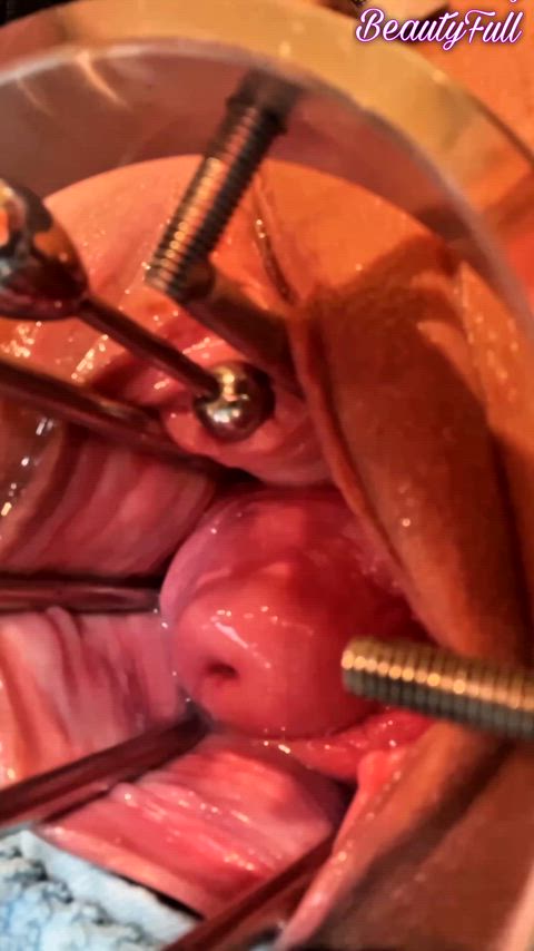 Is it just me, or is this super satisfying to watch? 🤔