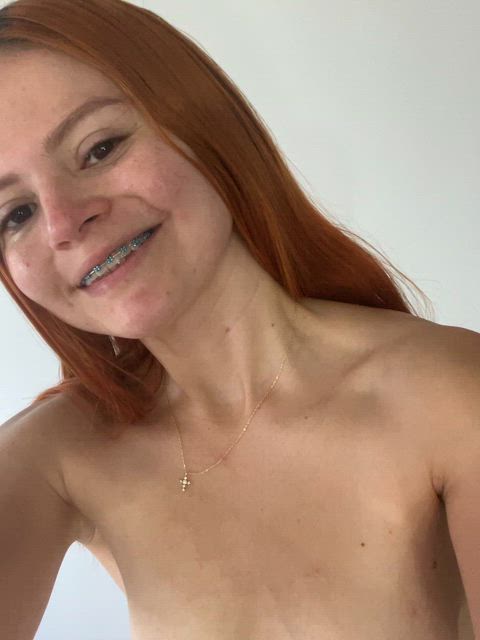 Rebellious, gleaming braces, owning every moment