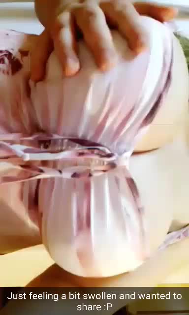 Swollen milky tits