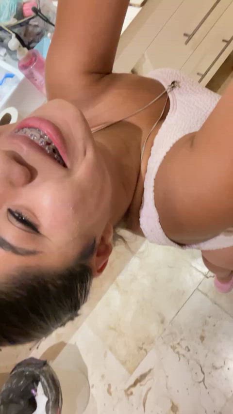 do braces make you a happy man?